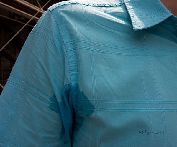 عرق زیاد نشانه چیست