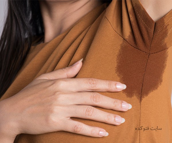 تعریق زیاد نشانه چیست