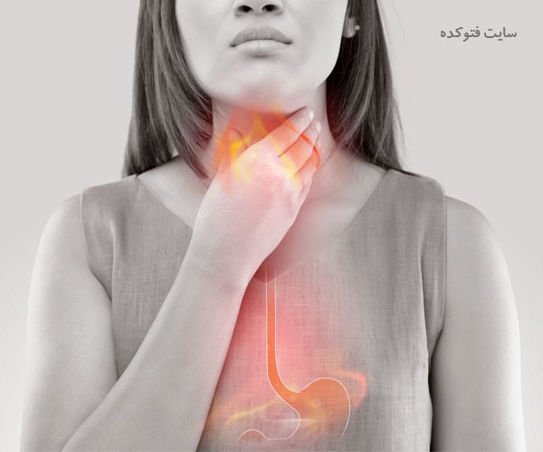 کاهش فوری اسید معده با 30 روش طب سنتی در خانه
