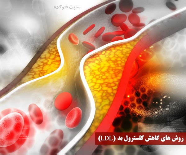 نحوه پایین آوردن کلسترول خون بالا