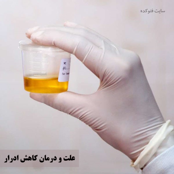 درمان کاهش ادرار در زنان و مردان