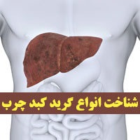 گرید های کبد چرب از ۱ تا ۴ + علت و روش درمان