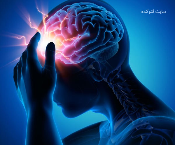 خوراکی مفید در پیشگیری از سکته مغزی