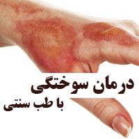 درمان سوختگی پوست با طب سنتی در خانه