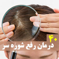 درمان سریع شوره سر با 40 روش در سایت فتوکده